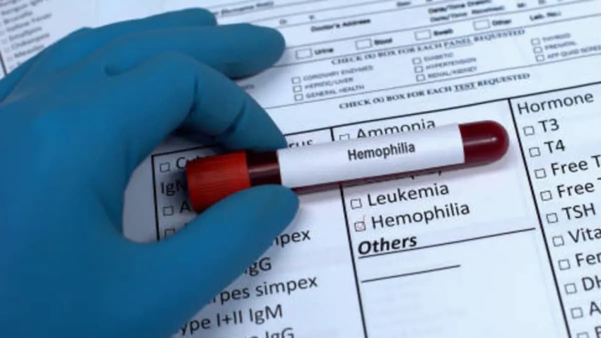 Médicos alertan: miles de niños con hemofilia en Colombia no consiguen medicinas que necesitan