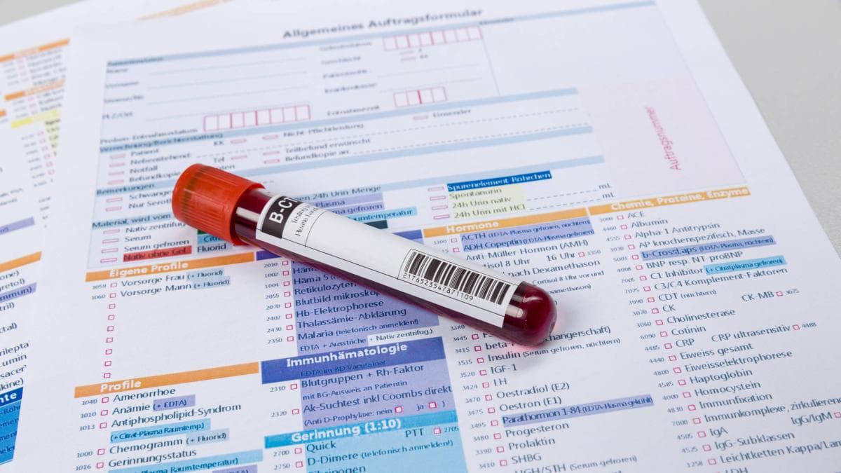 Menos exámenes, mejor prevención: qué chequeos realmente necesita según su edad