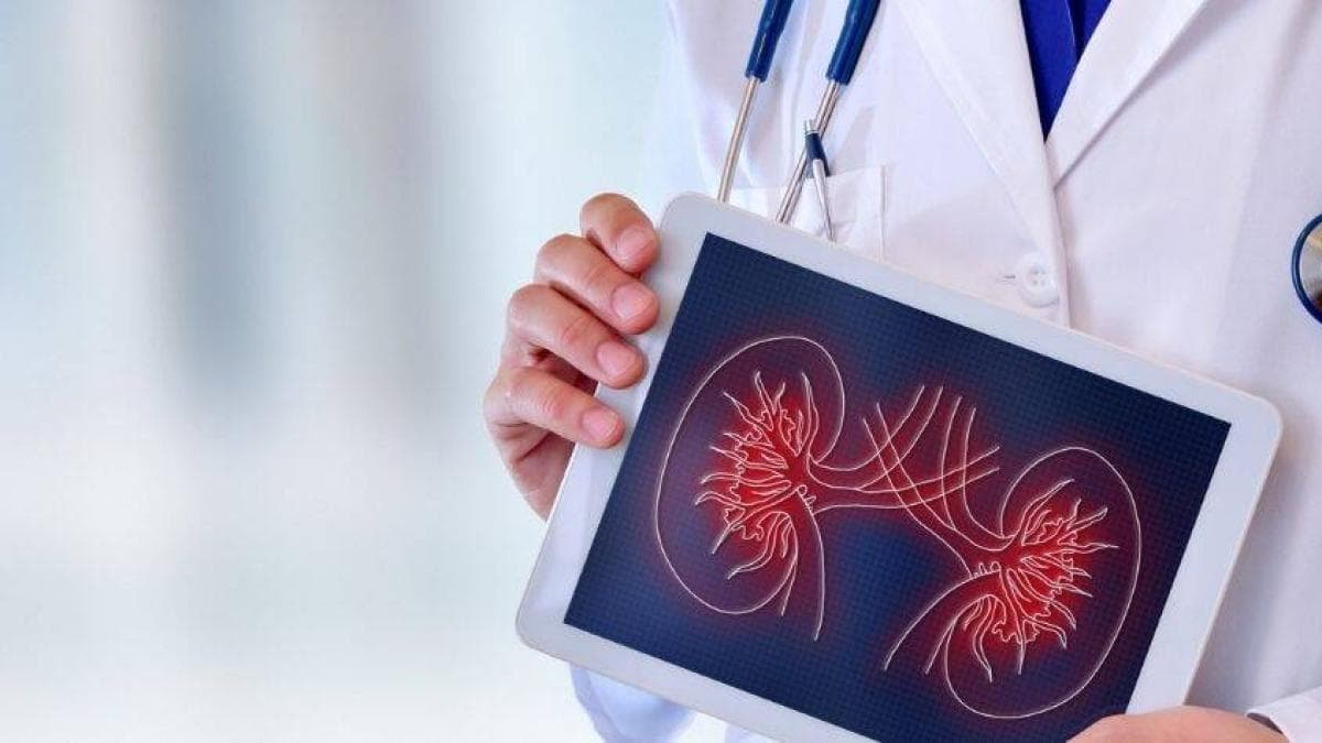 Los riñones silenciosos: expertos alertan que la enfermedad renal crónica puede robar hasta 16 años de vida