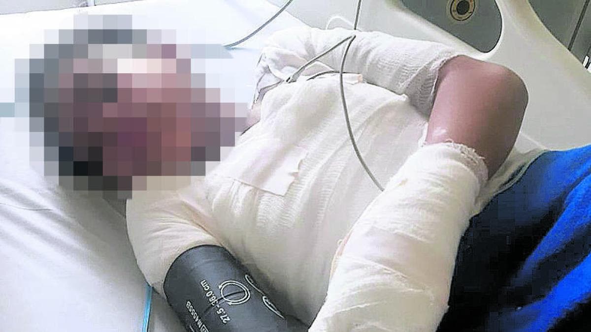 Atacante de niña en Suba tenía dos condenas y orden de captura vigente