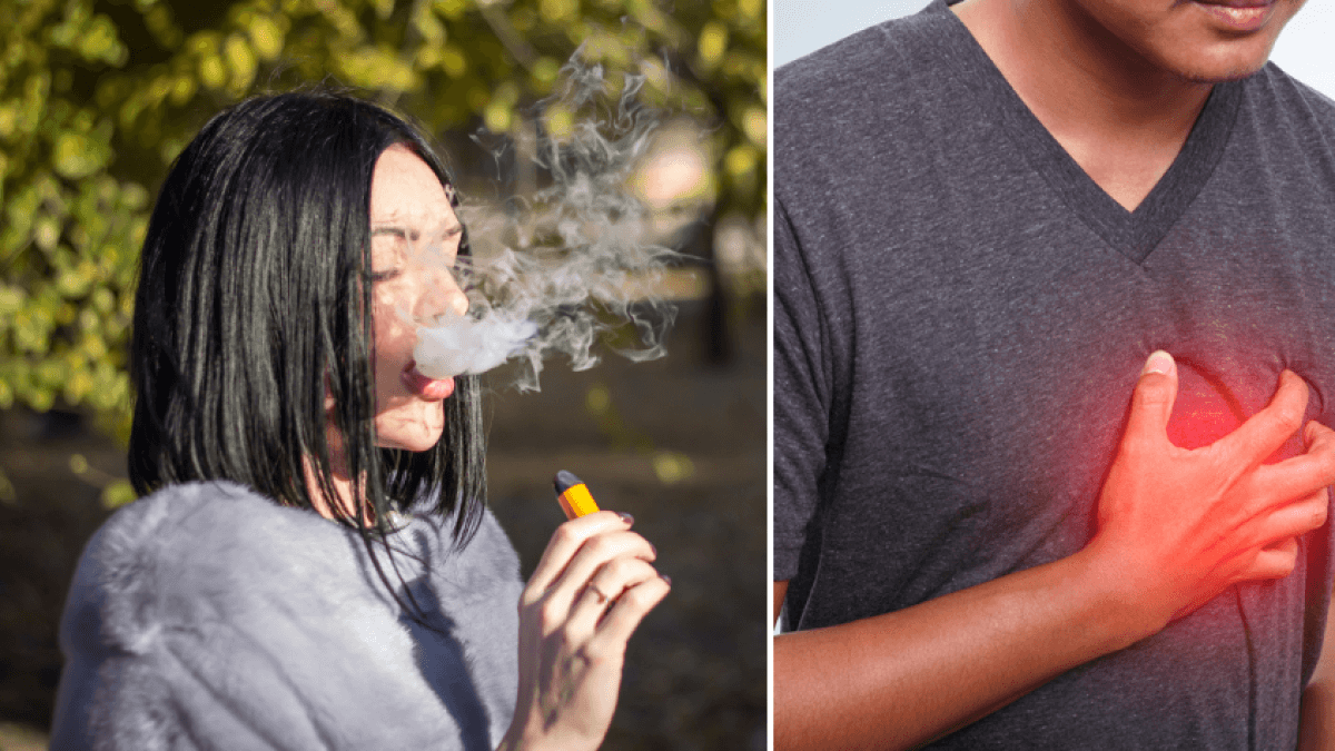 Liga Contra el Cáncer alerta: vapeadores causan EPOC y graves enfermedades pulmonares en jóvenes