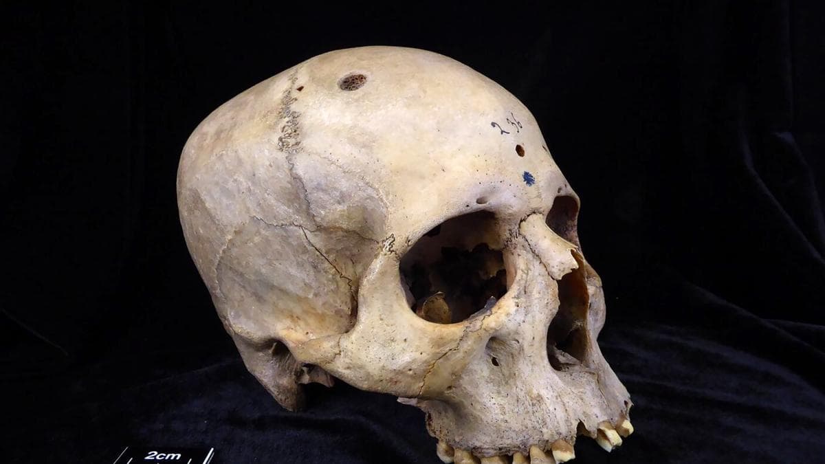 El cráneo humano cambió más en 100 años que en milenios: qué lo provocó