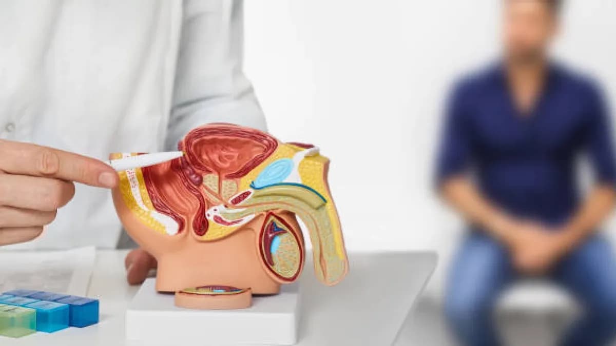 En Colombia, 4 de cada 10 casos de cáncer de próstata se detectan cuando ya es tarde