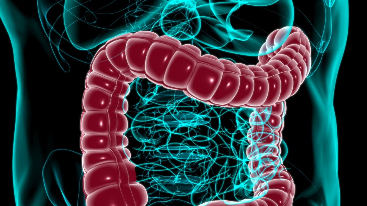 Sangrado al ir al baño: por qué no debe confundirse con hemorroides y cuándo buscar médico