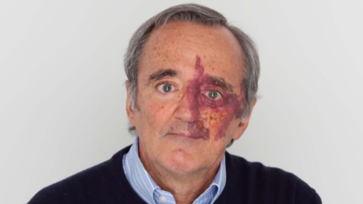 Academia de Ciencias de EE.UU. retira estudio sobre cáncer de páncreas por conflictos de interés no revelados