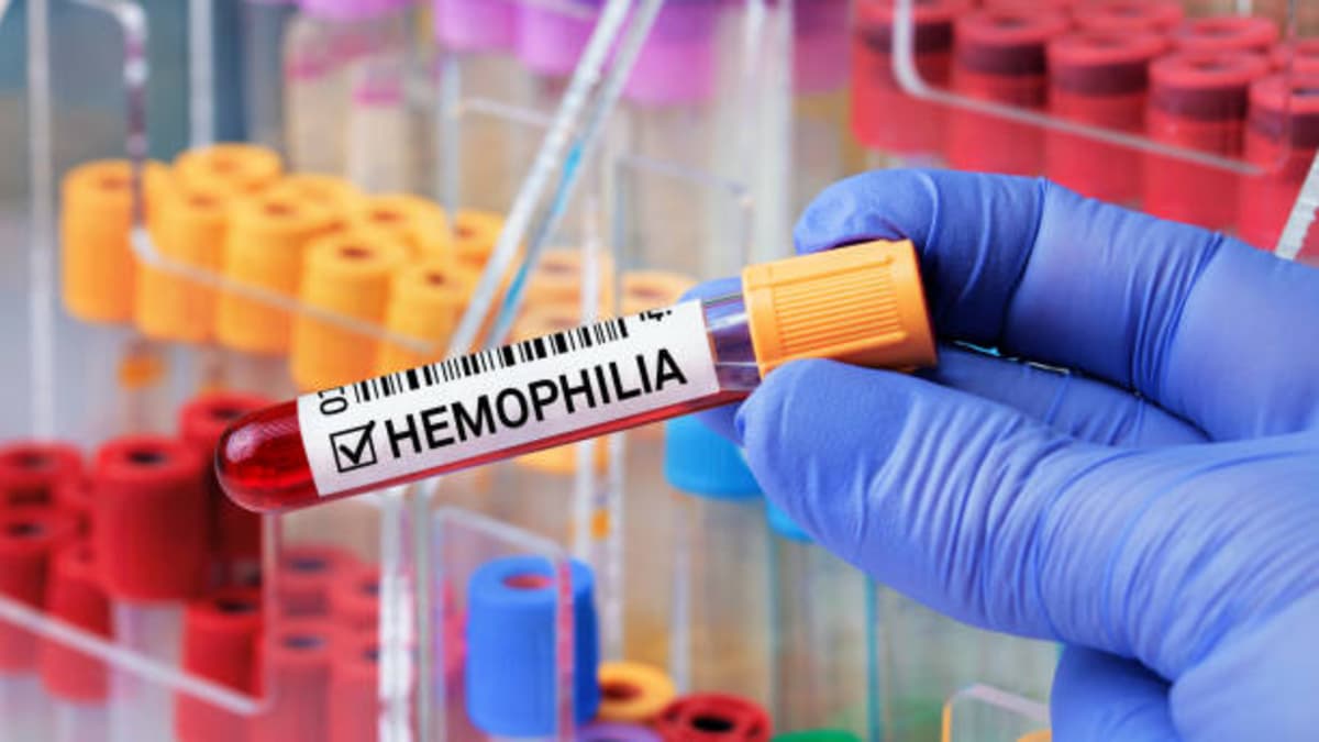 Hemofilia en Colombia: solo 6 de cada 10 pacientes reciben atención completa