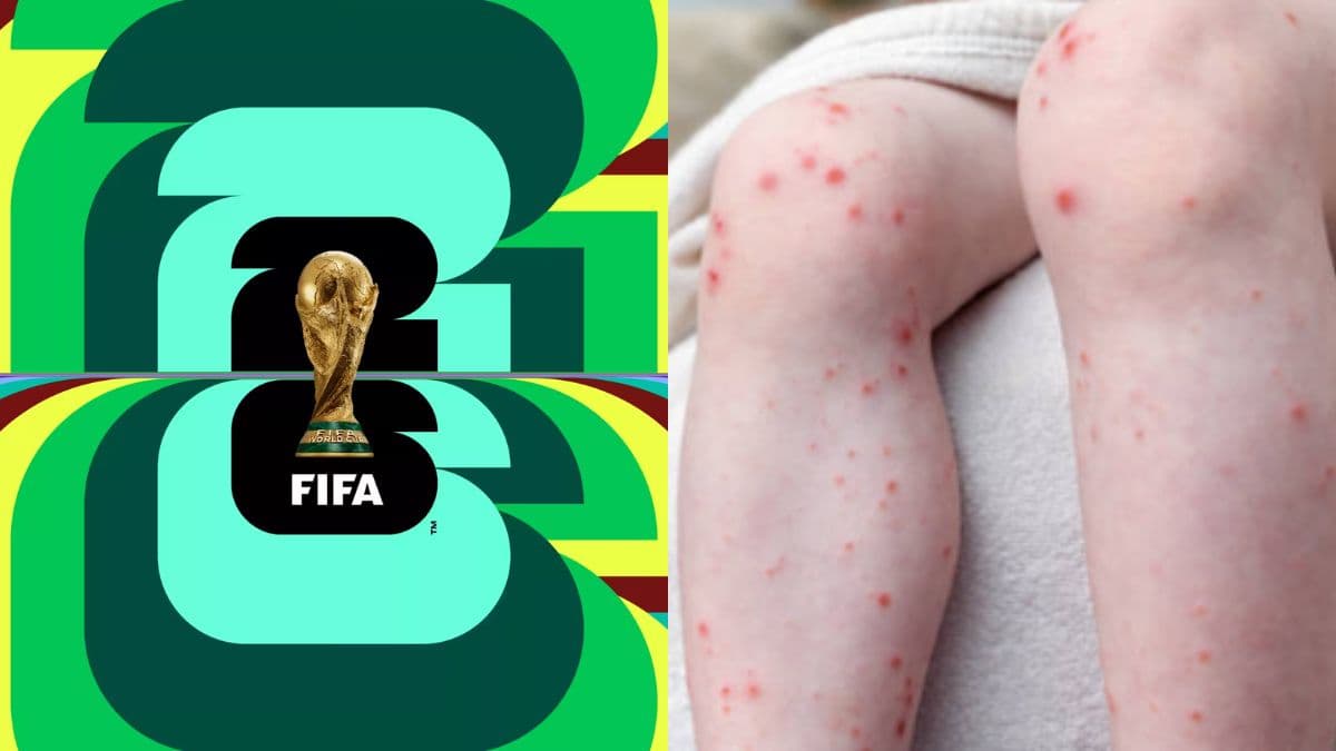 Ministerio de Salud alerta por riesgo de sarampión durante el Mundial 2026: qué hacer