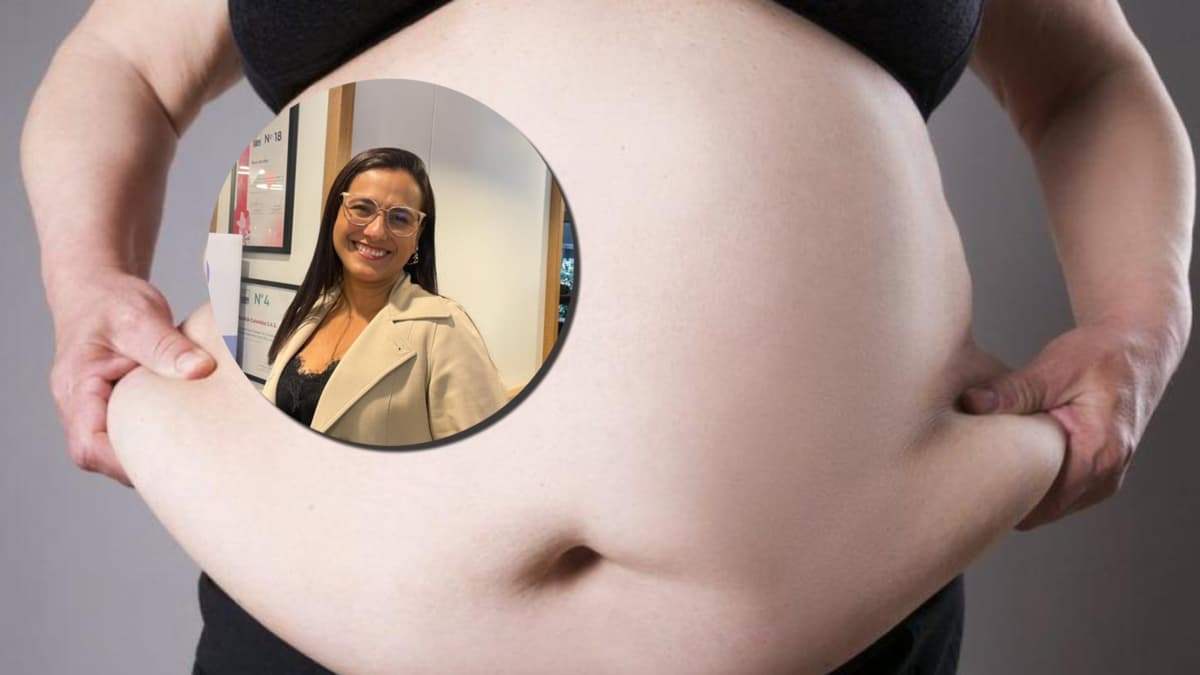 Sobrepeso u obesidad: no es solo estética, es una enfermedad que aumenta riesgos de salud