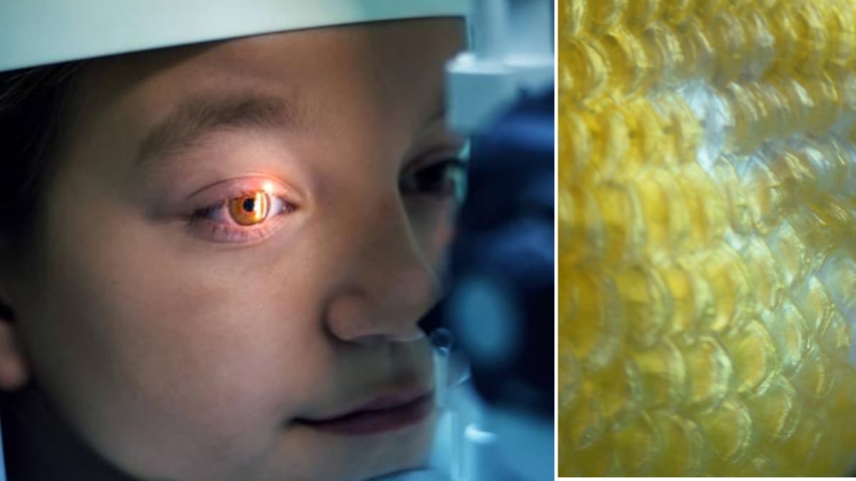 Científicos crean córneas artificiales con escamas de peces para evitar trasplantes