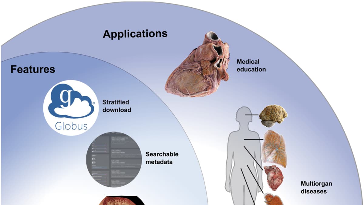 Crean atlas digital gratuito del cuerpo humano con imágenes en 3D de órganos completos