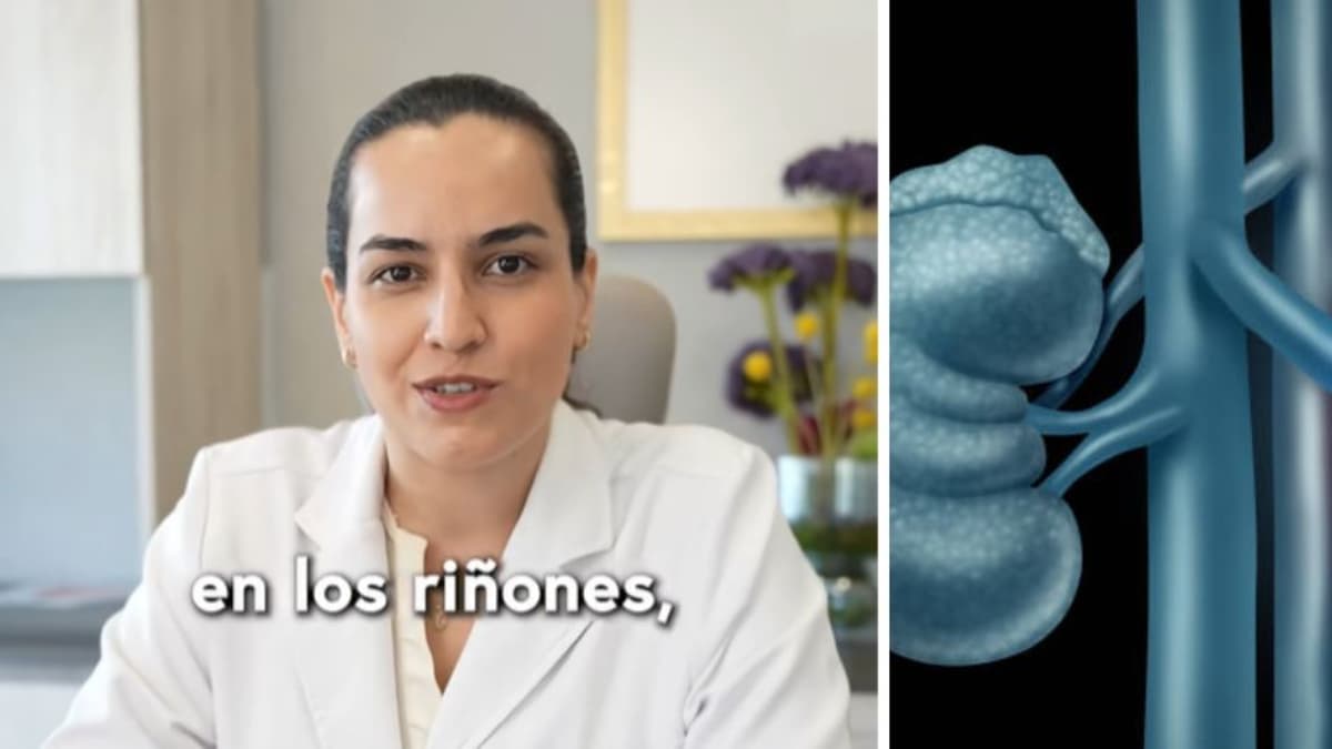 Uróloga aclara: no hay que eliminar lácteos para prevenir cálculos renales