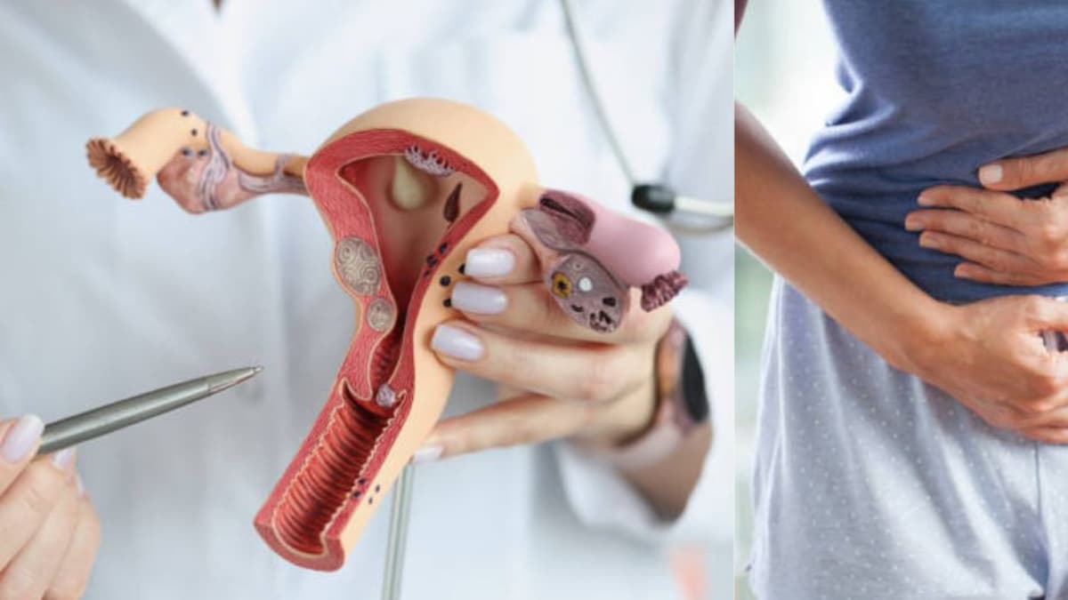 Tres señales silenciosas del cáncer de cuello uterino que muchas mujeres ignoran