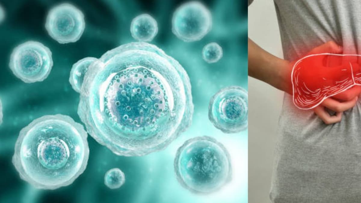 Descubren cómo las "células zombi" dañan el hígado y abren camino a nuevos tratamientos