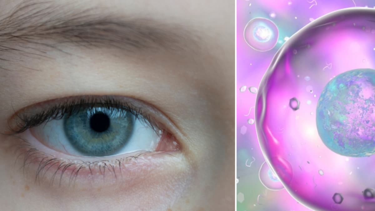 Científicos chinos prueban gotas oculares innovadoras contra el cáncer ocular infantil sin cirugía