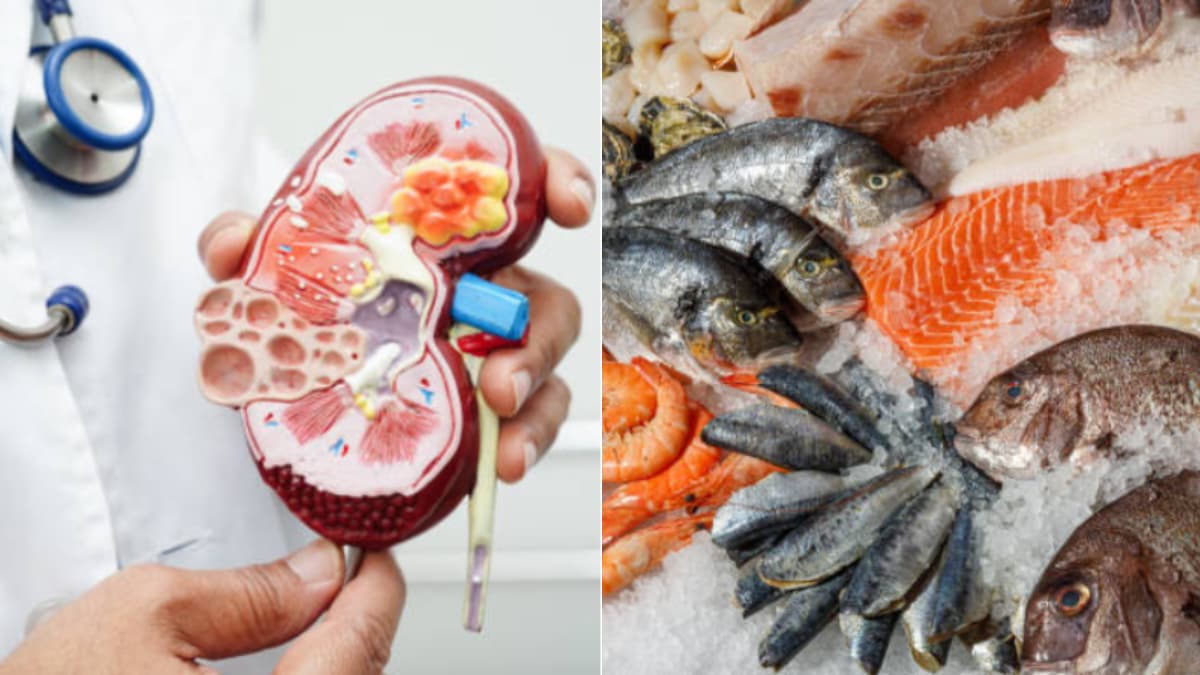 Qué pescados puede comer sin riesgo quien tiene problemas de riñones