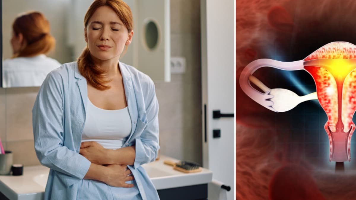 Dos señales que pueden alertarle sobre síndrome de ovario poliquístico