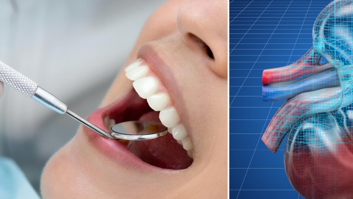 Descubren que la salud de tus dientes influye en el funcionamiento de los riñones