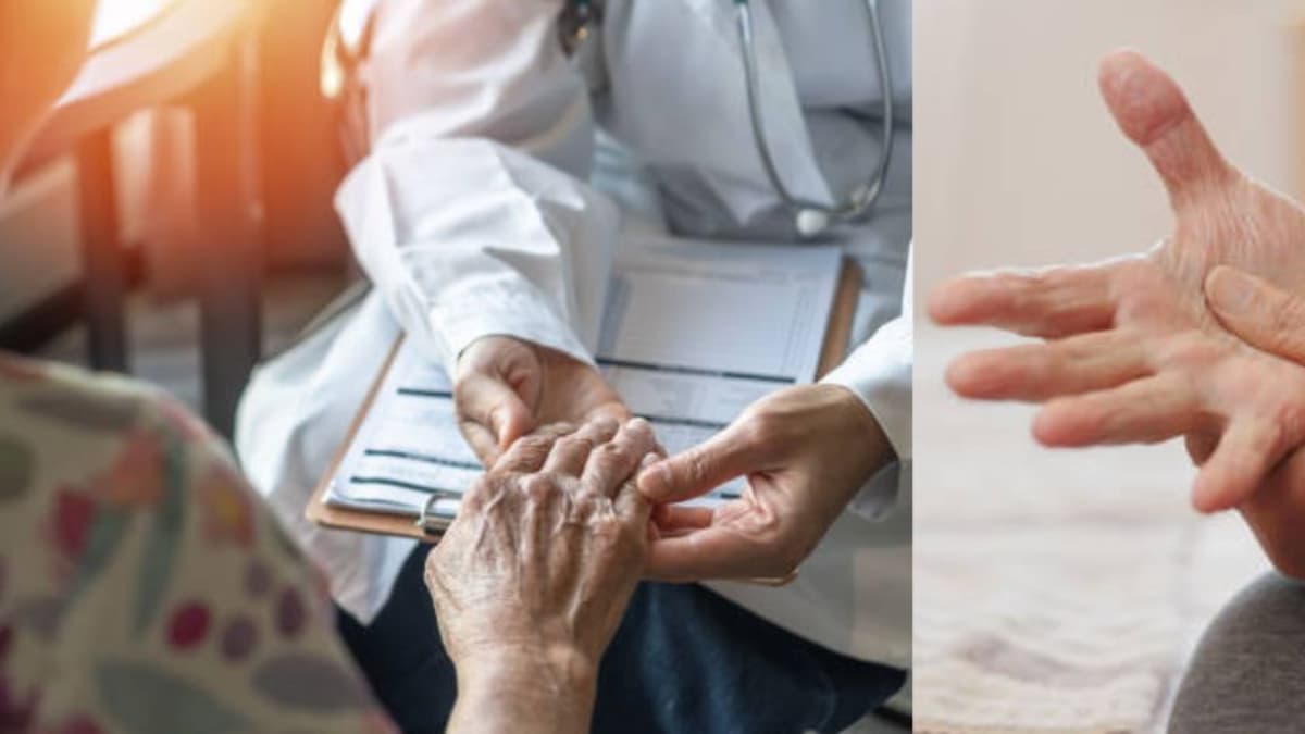 Parkinson: reconoce los primeros síntomas de esta enfermedad neurológica y qué opciones de tratamiento existen