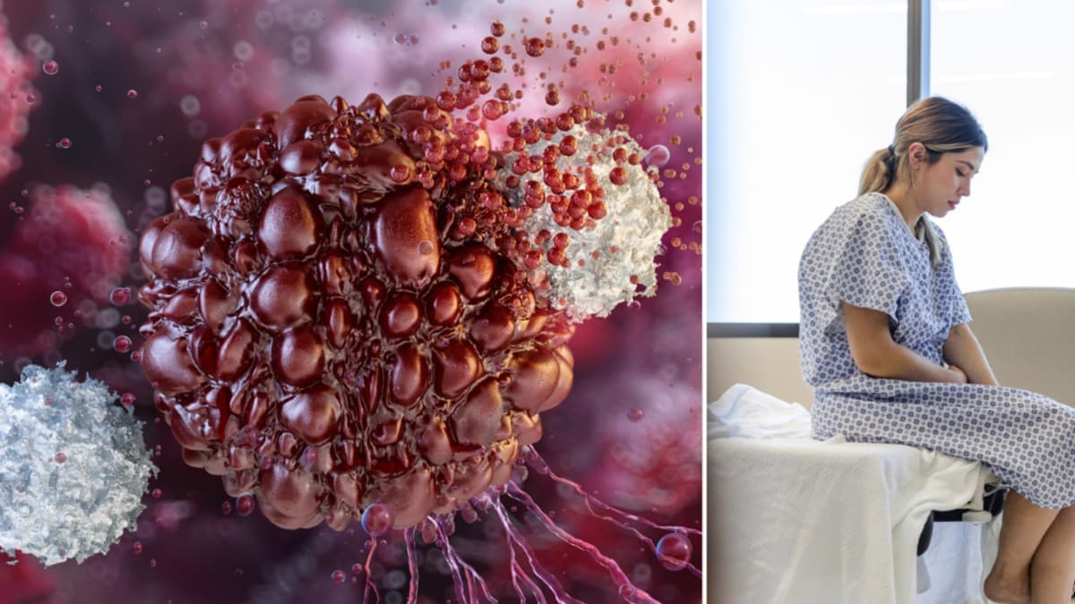 La sarcoidosis, la enfermedad que imita otras y se oculta en múltiples órganos del cuerpo