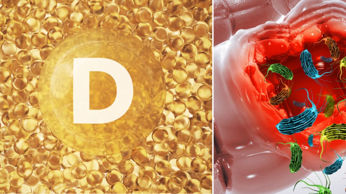 Vitamina D podría ayudar a controlar enfermedades inflamatorias del intestino, según estudio