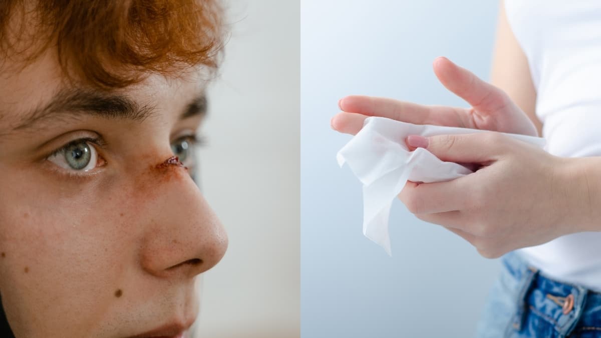 Invima alerta: las toallitas húmedas no deben usarse en heridas ni lesiones abiertas