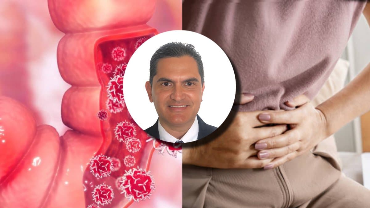 Alerta por aumento de enfermedad inflamatoria intestinal en Colombia: no ignore estos síntomas