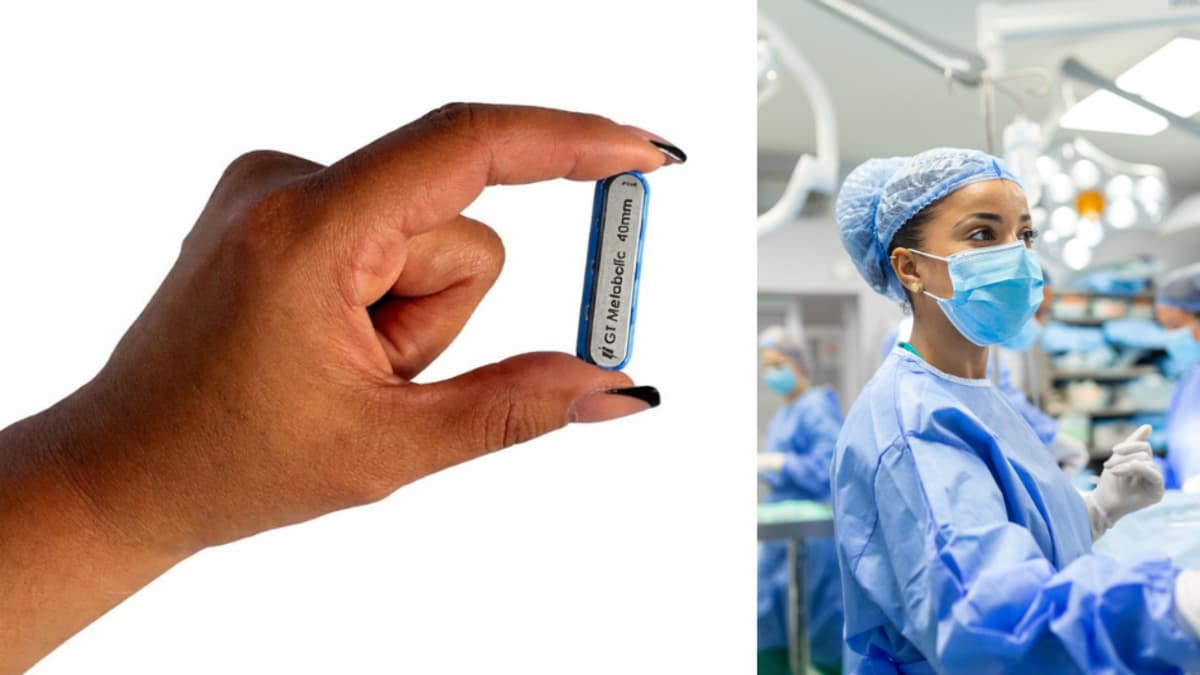 Imanes que se comen: la nueva técnica que llega a Colombia para tratar la obesidad sin cirugía mayor