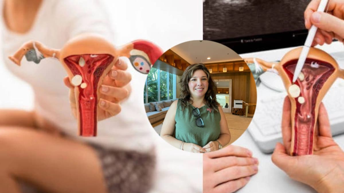 Cáncer de ovario: el tumor ginecológico más letal que pasa desapercibido en Colombia