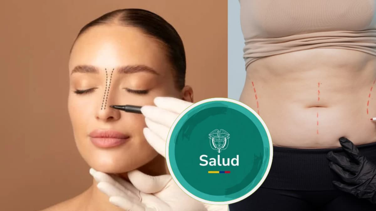 A partir de 2026, las EPS no cubrirán rinoplastia, liposucción ni otras cirugías puramente estéticas