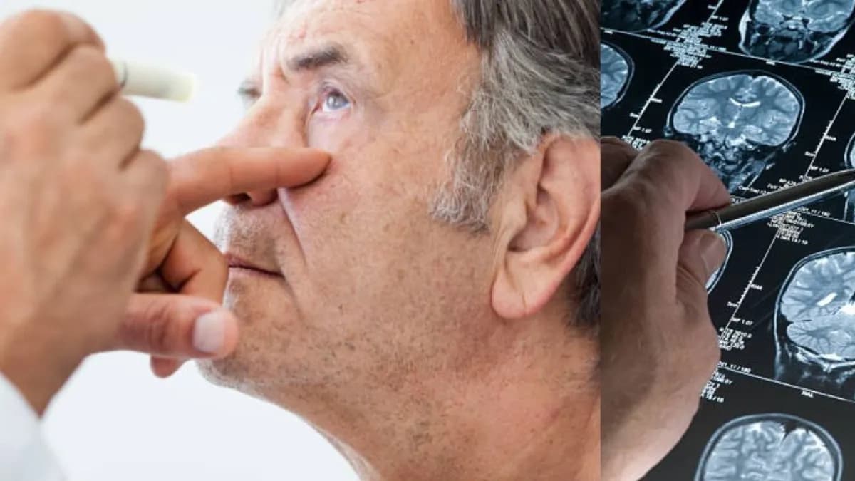 Los ojos podrían detectar Alzheimer y Parkinson años antes de que aparezcan síntomas