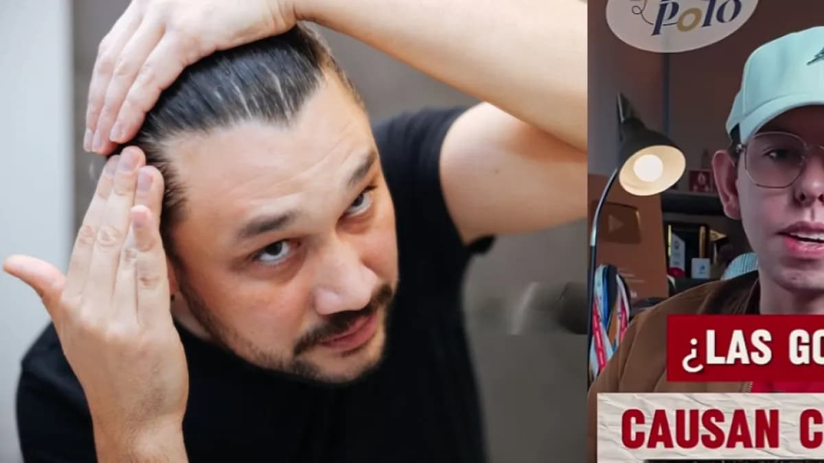 ¿Usar gorra causa calvicie? Dermatólogos aclaran los mitos más comunes sobre la alopecia
