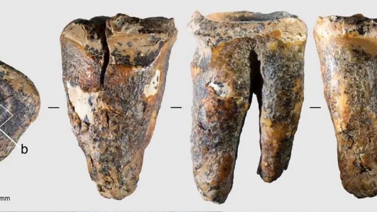 Neandertales practicaban odontología: hallazgo de 60.000 años revela tratamiento dental intencional