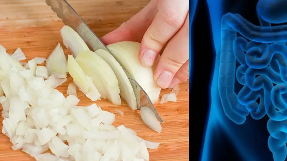 Descubren que un compuesto de la cebolla podría ayudar contra el cáncer de colon