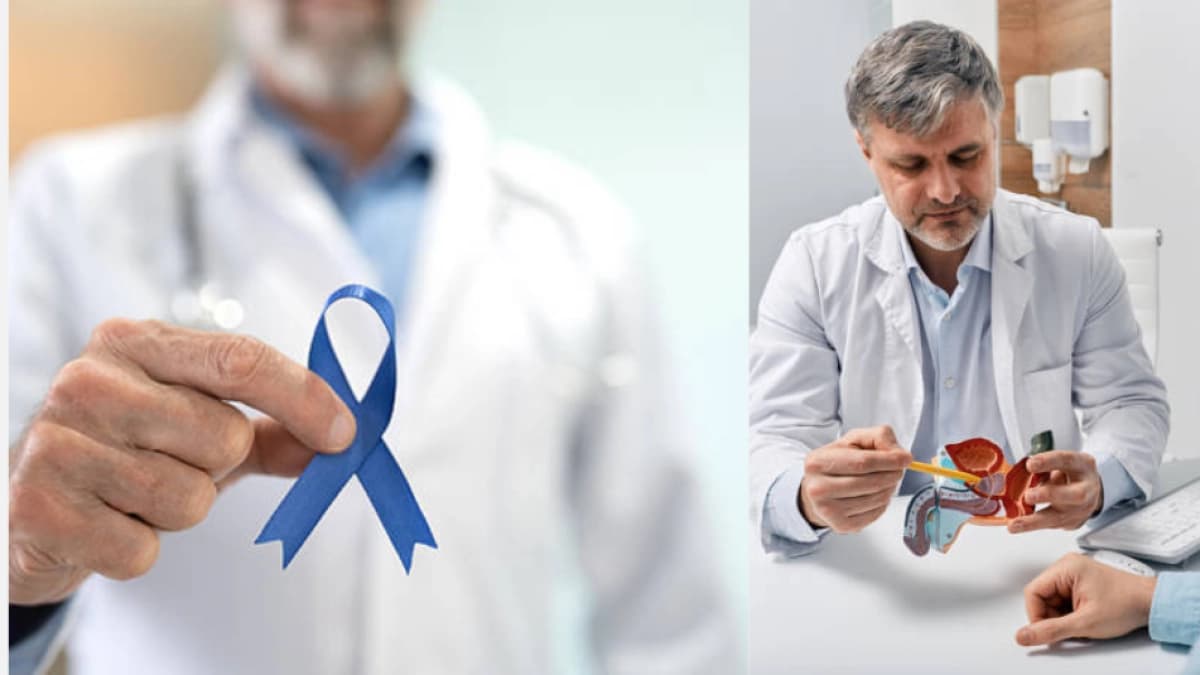 Cáncer de próstata: qué hábitos pueden reducir el riesgo en hombres colombianos