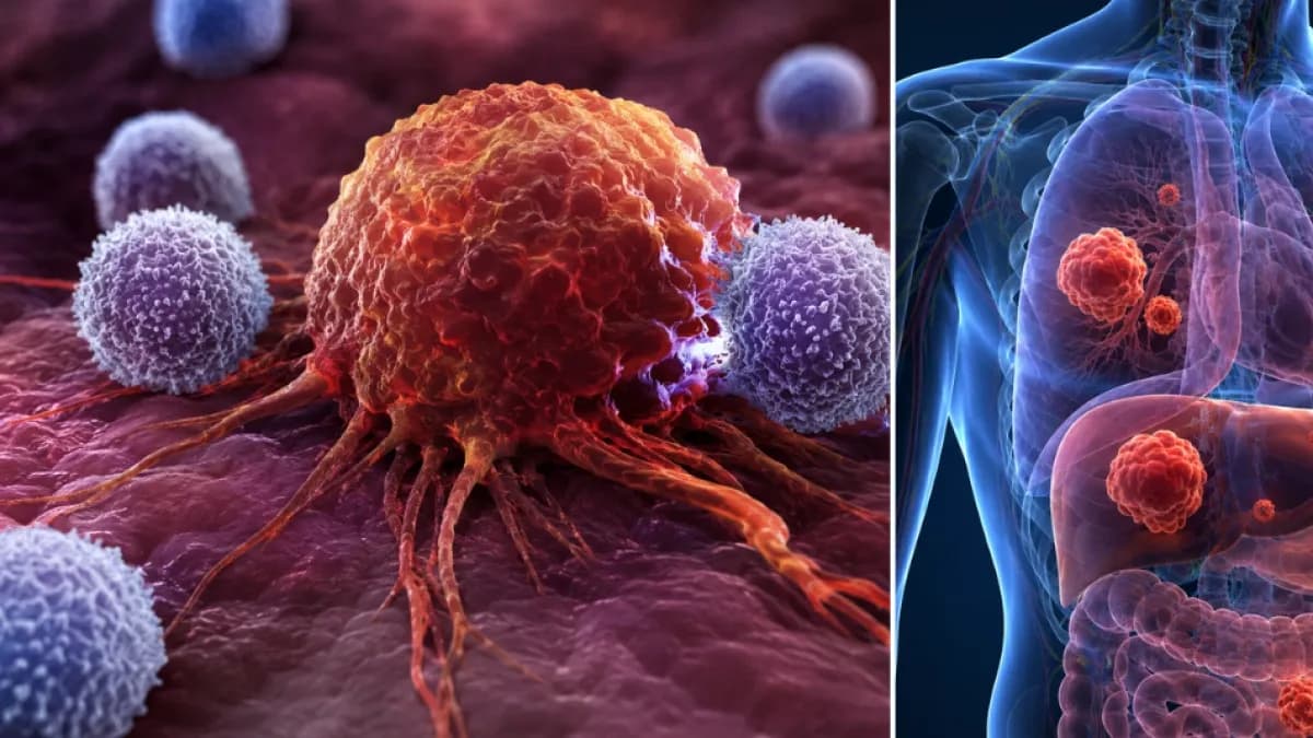 Científicos descubren células cancerosas pequeñas que hacen tumores más agresivos y resistentes
