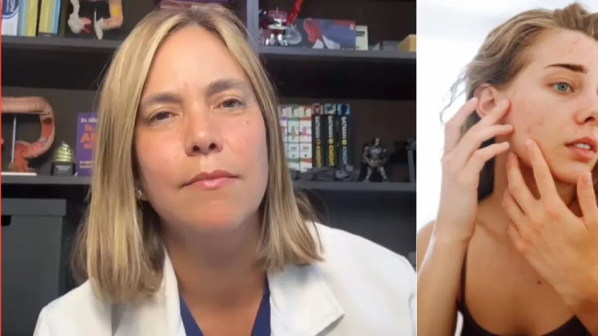 Tu piel refleja lo que sucede en el intestino: qué dice la gastroenteróloga Juliana Suárez