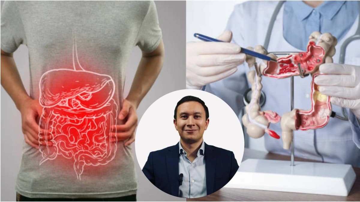 Cáncer colorrectal avanza entre adultos jóvenes: experto pide no ignorar síntomas digestivos