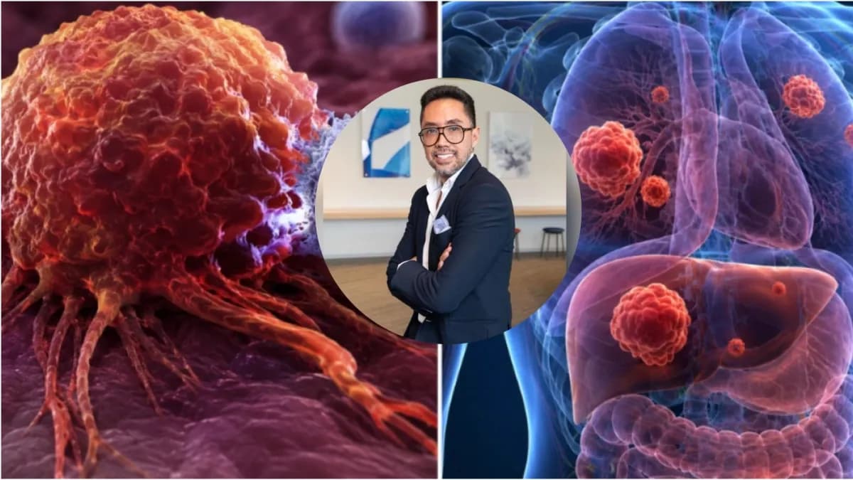 Una de cada cinco personas tendrá cáncer en su vida: qué hacer para reducir el riesgo