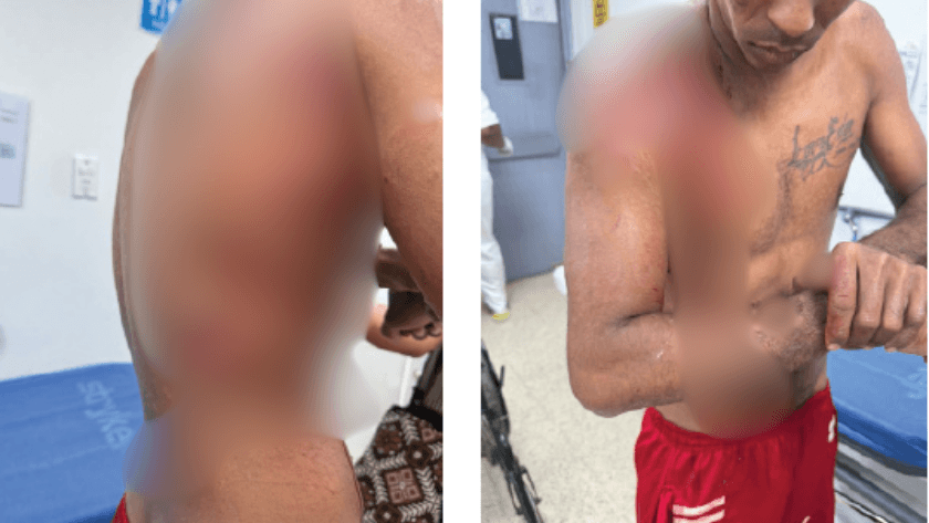 Hombre atacado por caimán en La Enea, entre Riohacha y Dibulla