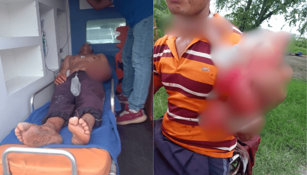 Pastor atacado a machetazos en su iglesia lucha por su vida en Barinas