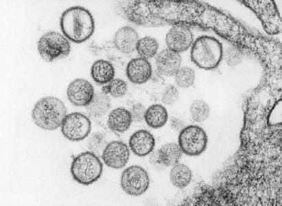 Tu genética decide si sobrevives al hantavirus: la "lotería" que determina la gravedad