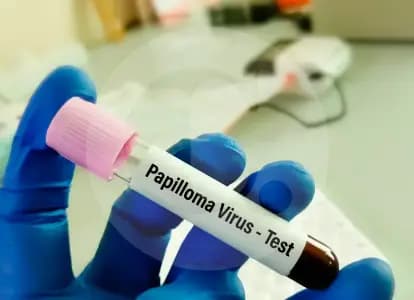 El VPH sigue siendo una amenaza silenciosa en Colombia: más de 62.000 pruebas revelan su alta circulación