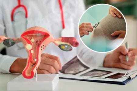 Corte abre puerta para revertir ligadura de trompas: primera sentencia que reconoce el derecho a cambiar de opinión sobre maternidad