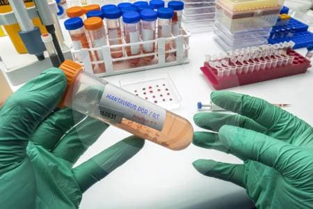 Nebraska logra en 48 horas una prueba PCR para detectar hantavirus antes de los síntomas
