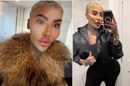 Muere influencer británico conocido por sus múltiples cirugías estéticas; investigan posibles complicaciones