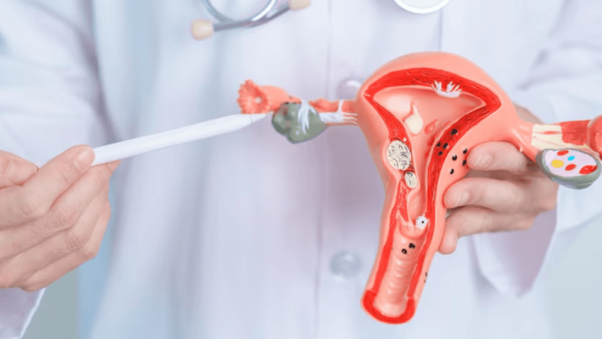 Cáncer de cuello uterino: el segundo más frecuente en Colombia pero totalmente prevenible con detección a tiempo