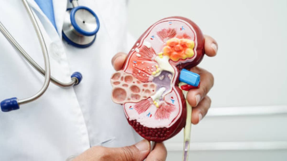 Nueve alimentos que favorecen las piedras en los riñones y cómo reemplazarlos en la dieta