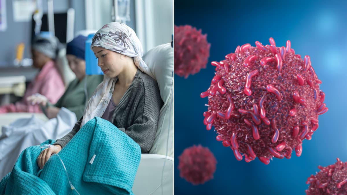 Fundaciones denuncian ante CIDH retrasos en tratamientos de cáncer y enfermedades hepáticas en Colombia