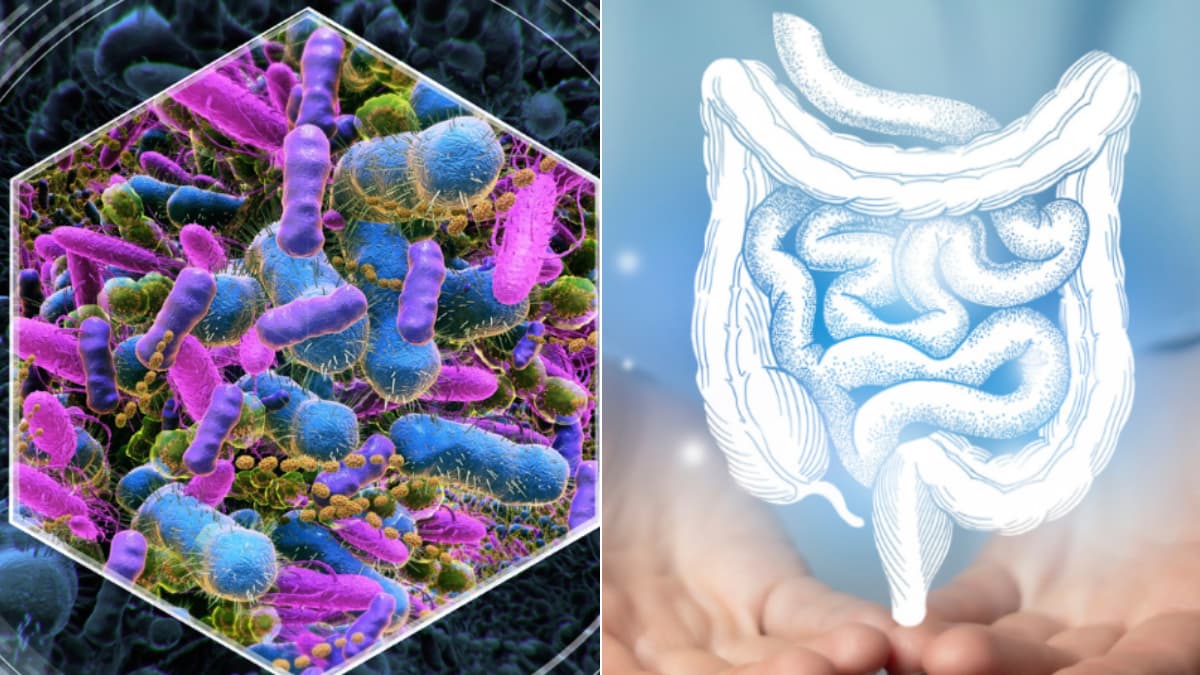 Descubren nueve moléculas intestinales en la sangre que predicen riesgo de infarto