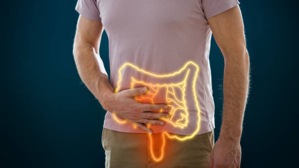 Científicos descubren que dieta, tabaco y pesticidas aumentan riesgo de cáncer de colon en jóvenes